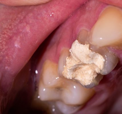 Dental Pulps