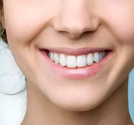 Smile Makeovers